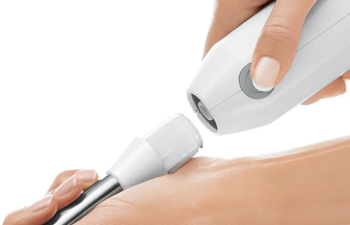 Bosch MSM66110 600W White ErgoMixx Hand Blender - Image 3